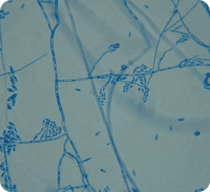 Prevención de plagas y enfermedades